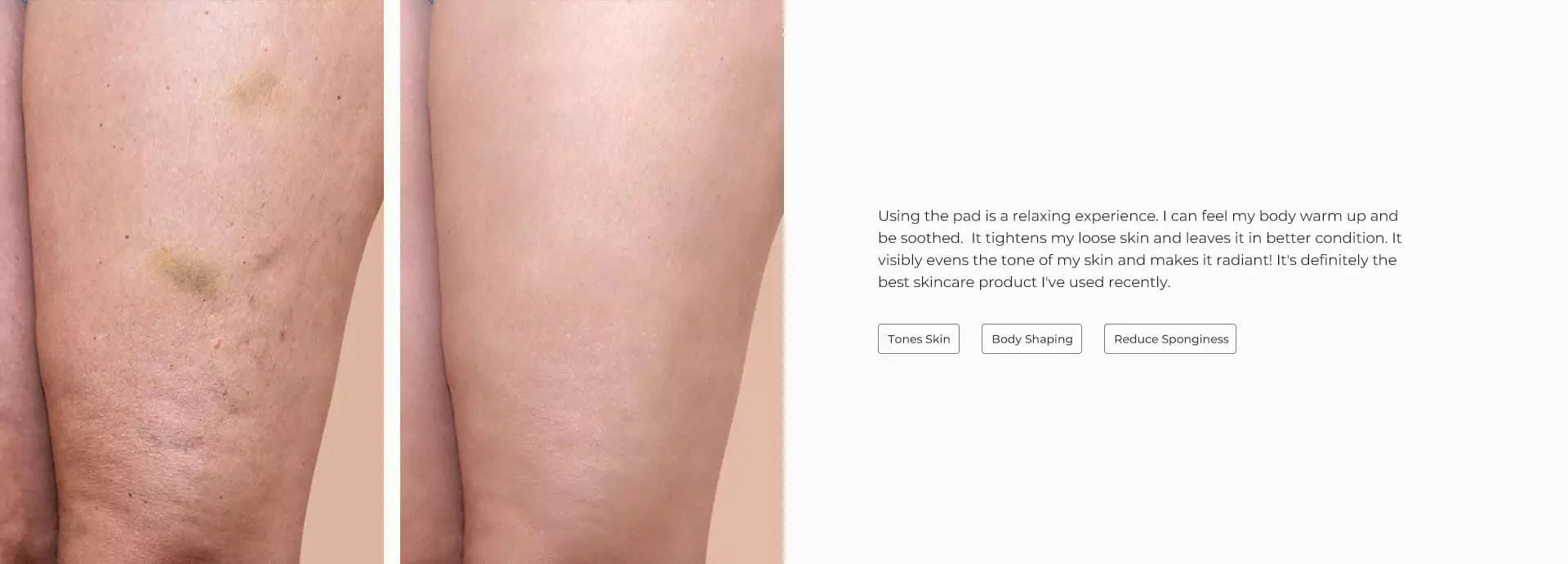 SciContour Body Pad Plus customer results-Improved my skin