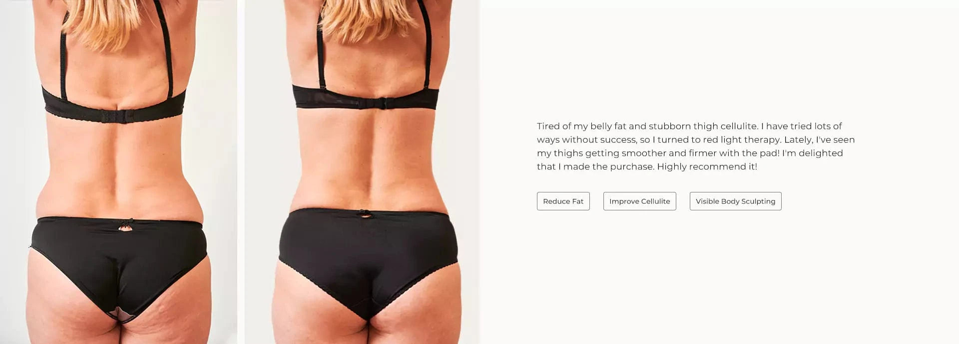 SciContour Body Pad Plus Customer Results-Away from cellulite