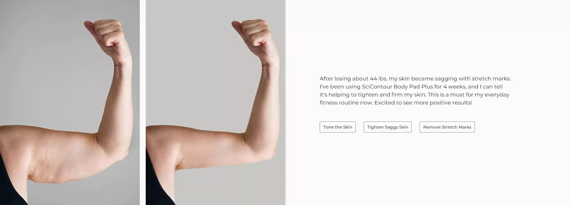 SciContour Body Pad Plus customer review-tighten and firm my skin