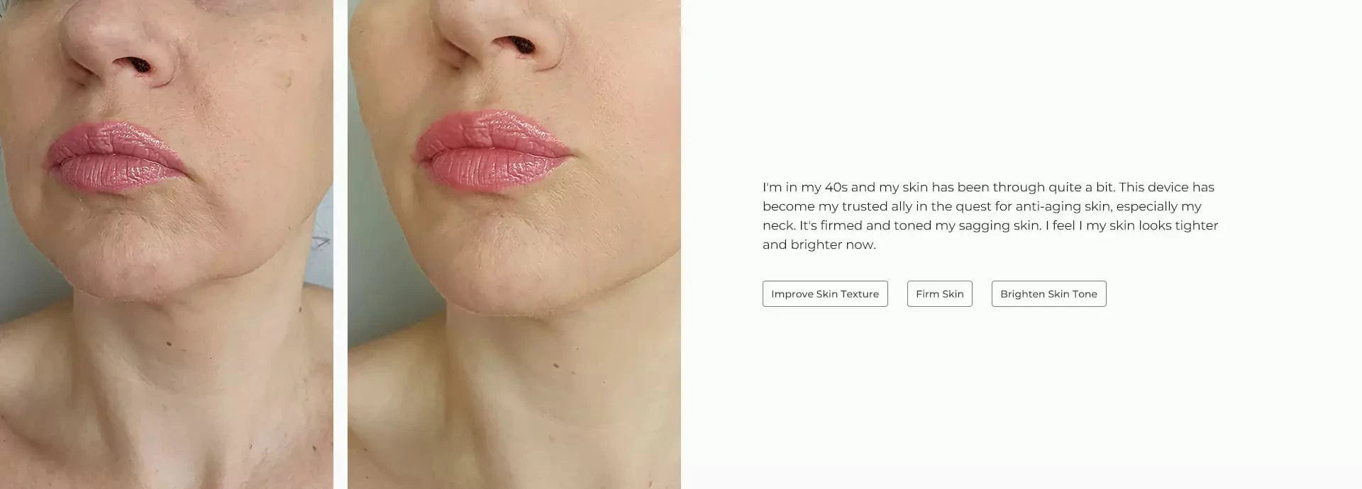 Good feedback from customer- Firm my skin