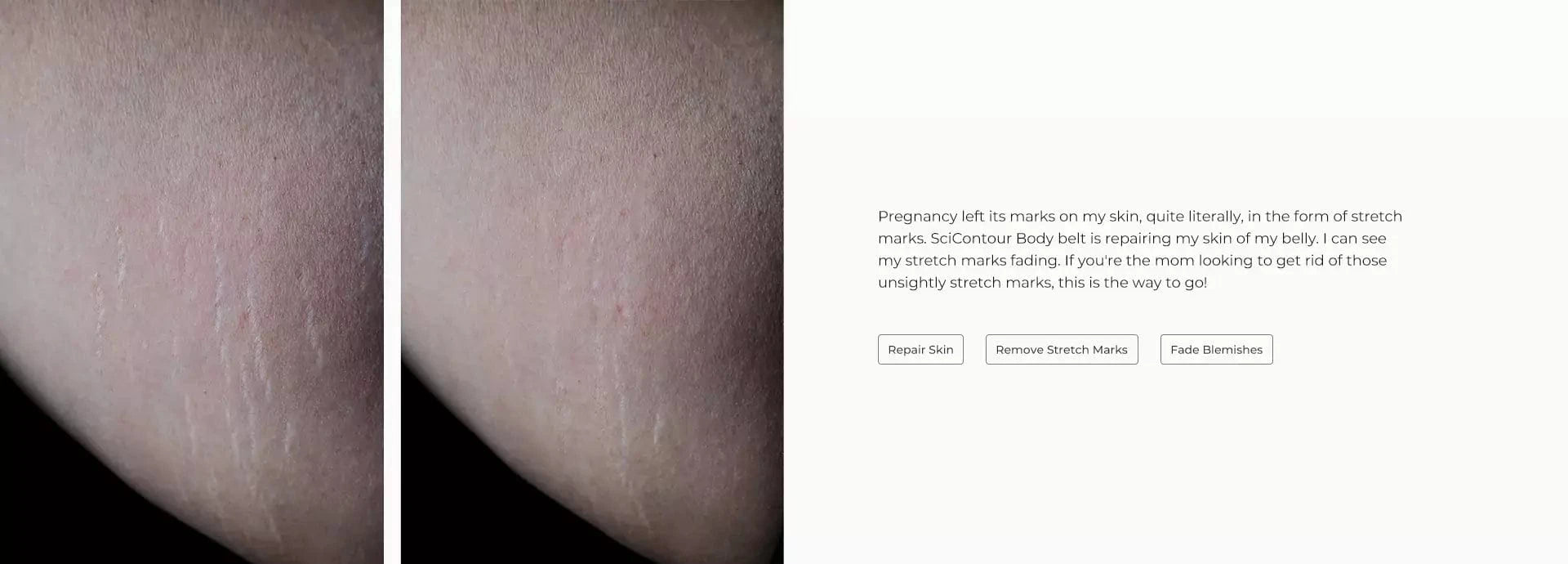 Good feedback from customer- Repair my skin