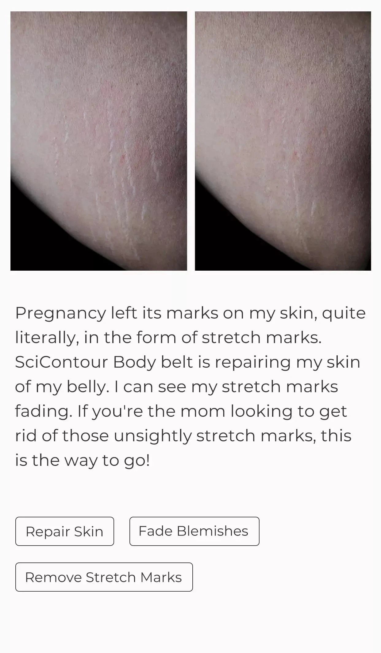 Good feedback from customer- Repair my skin