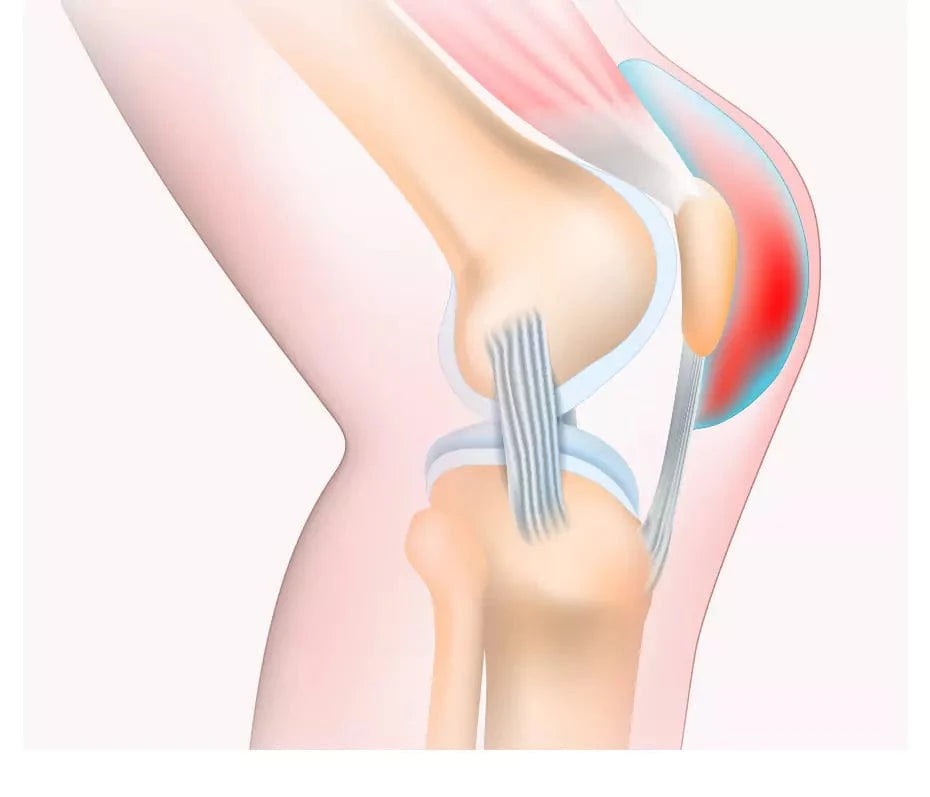 REDUCE INFLAMMATION