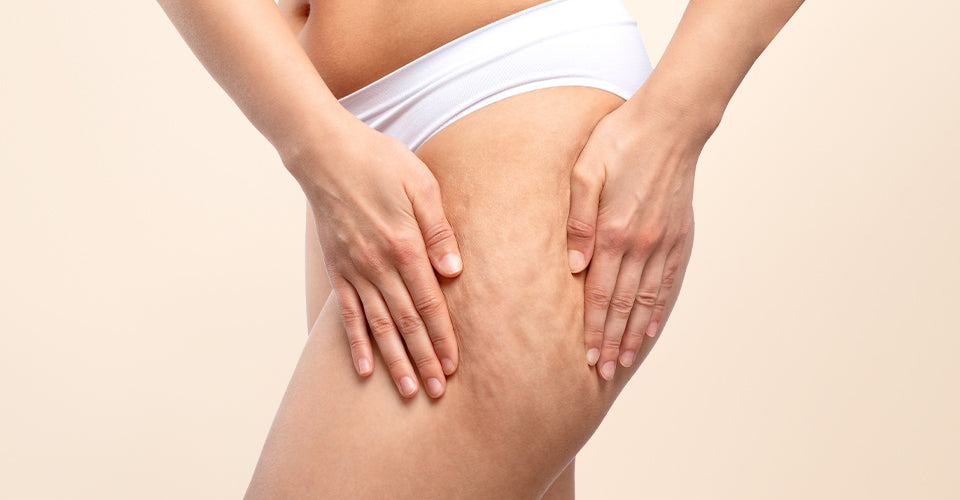 Exploring Different Ways to Get Rid of Cellulite on The Thighs