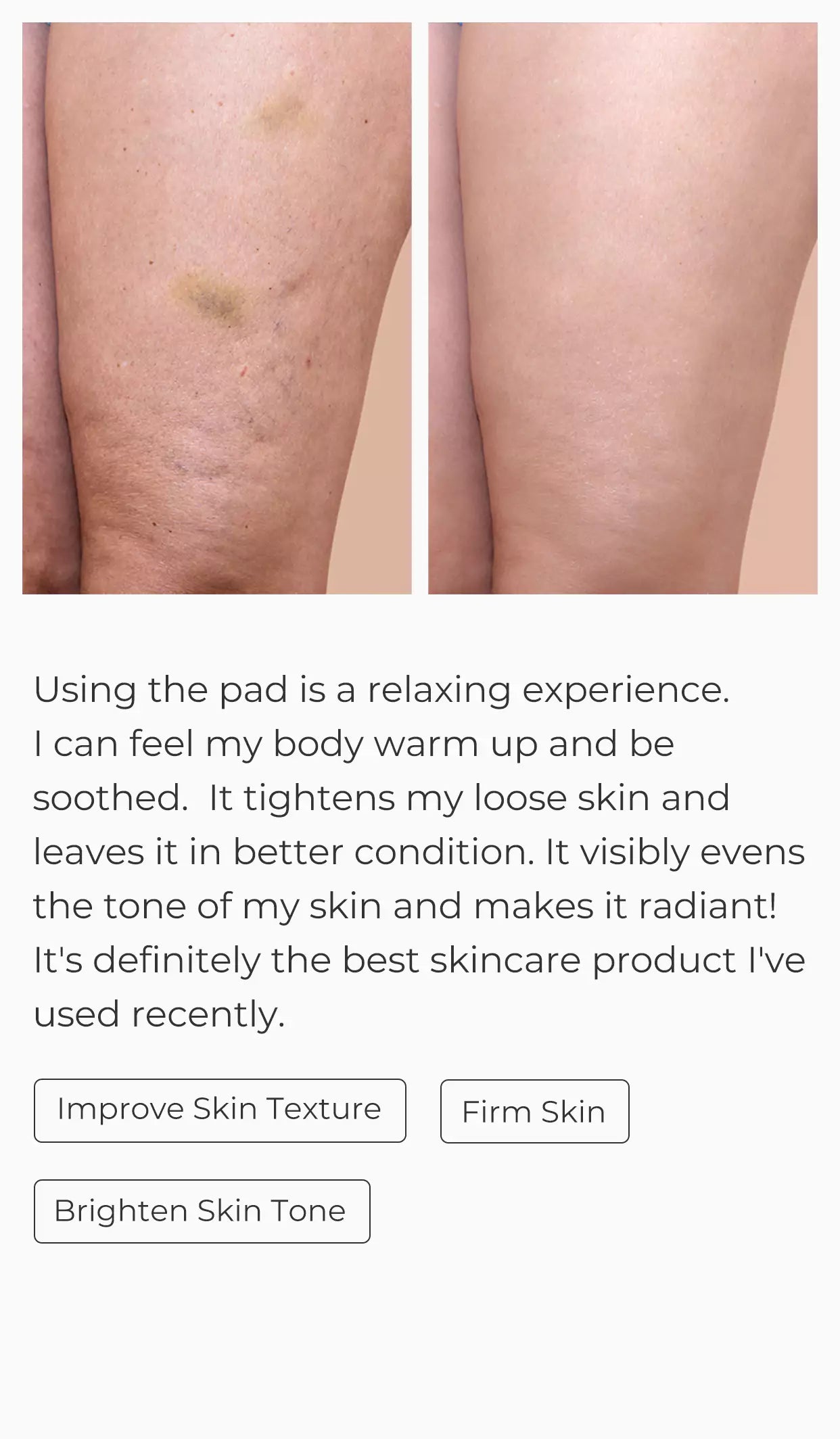 SciContour Body Pad Plus customer results-Improved my skin