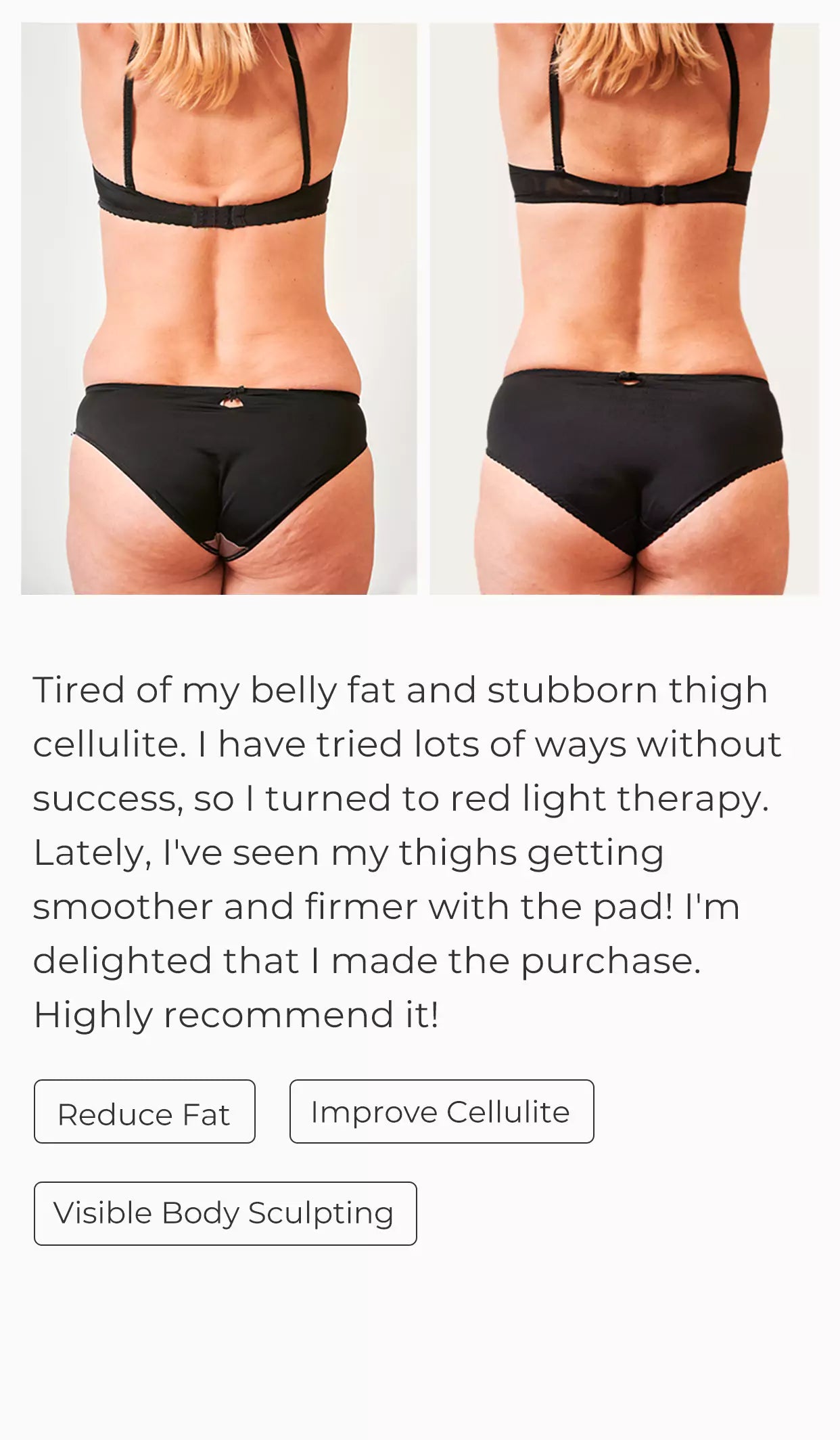 SciContour Body Pad Plus Customer Results-Away from cellulite