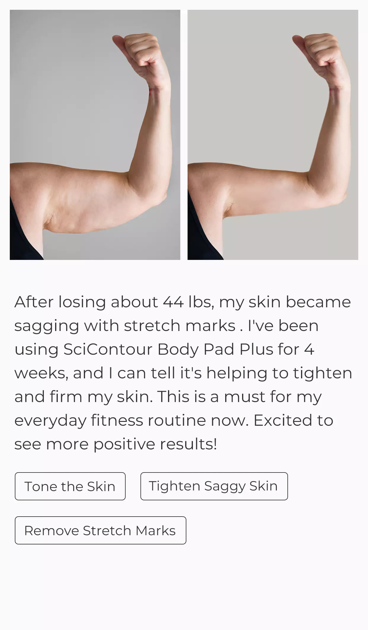 SciContour Body Pad Plus customer review-tighten and firm my skin