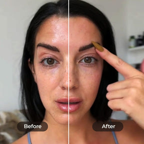 EFC-12.Facialcupping