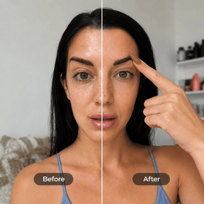 EFC-12.Facialcupping